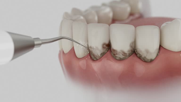 Reliable Dental Implants contractor in Georgetown, DE by Smile Center Dentistry